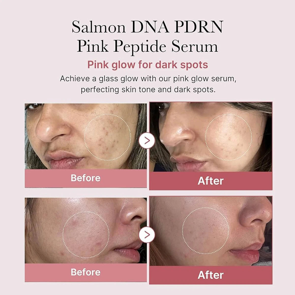 Medicube Salmon DNA PDRN Pink Peptide Serum,Smooth Texture&Quick Absorption,Lightweight&Non-Greasy,Korean Skincare,Korean Makeup
